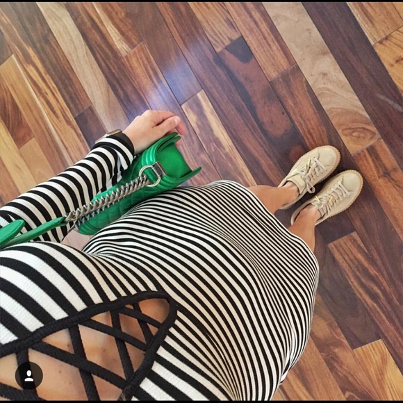 Black and white stripes dress - Picture 2 of 2